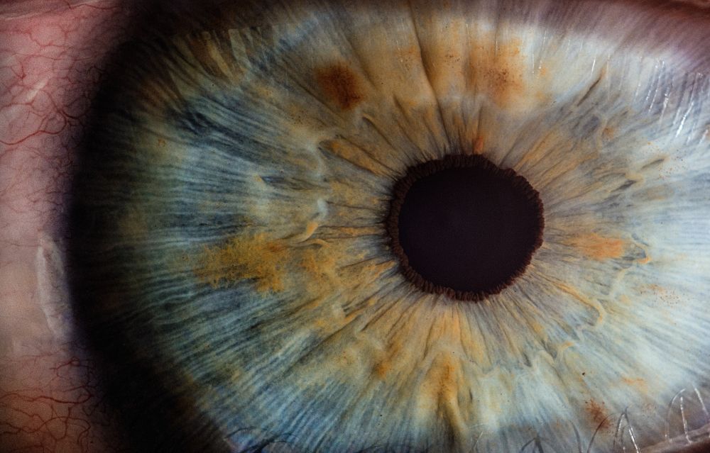 En ögonlaserbehandling kan förbättra ditt liv