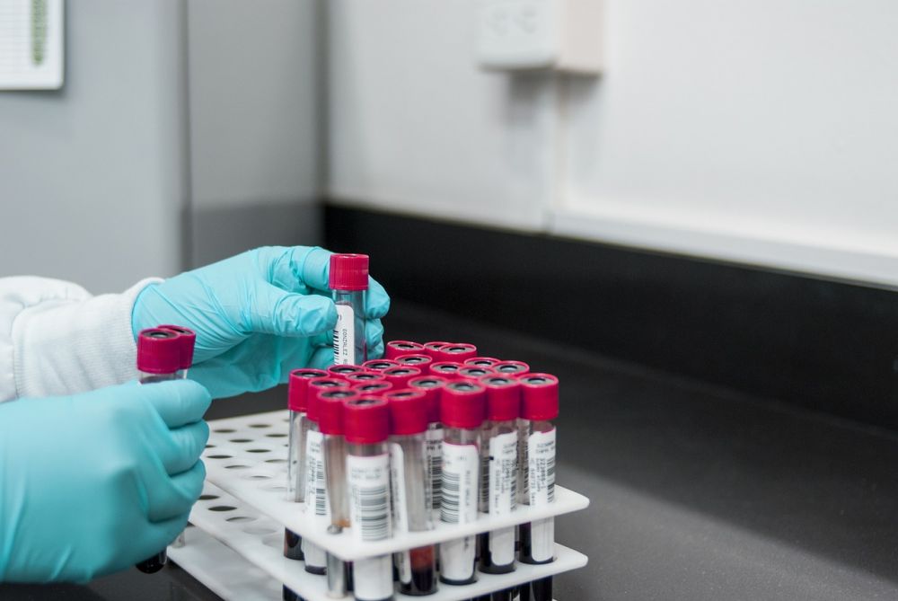 Blodanalys – ett viktigt verktyg för att förebygga och upptäcka sjukdomar